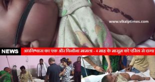 superstition innocent child stained acid Madhya Pradesh Treatment Sawai Madhopur Hospital