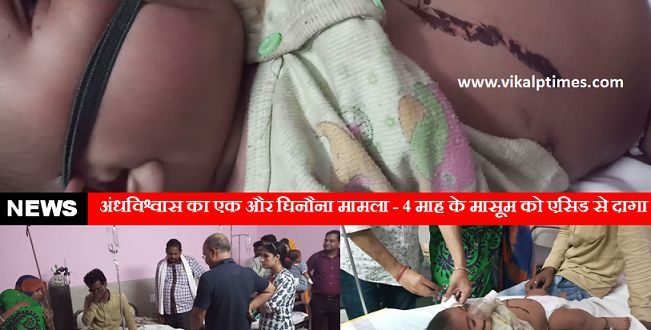 superstition innocent child stained acid Madhya Pradesh Treatment Sawai Madhopur Hospital