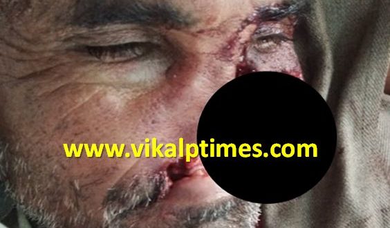 Wildlife animal attack youth malarna dungar