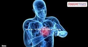 Hassan district Karnataka Medical Health News 01 July 25