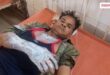 When the shopkeeper asked for money for kachori then he poured boiling oil on him in gangapur city Vikalp Times